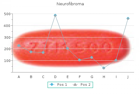 buy 25  mg seroquel free shipping